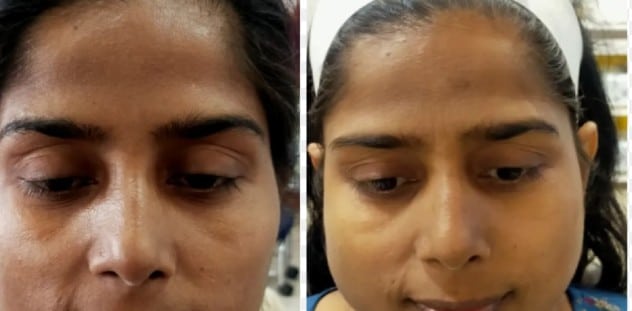 Image #1 from – Anjali Rao, Chennai