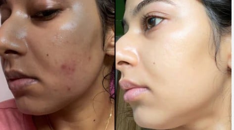 Image #1 from – Priya Menon, Bengaluru
