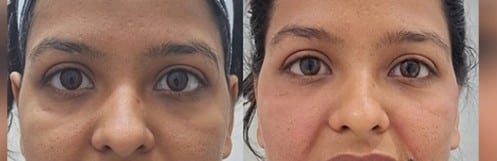 Image #1 from – Neha Sharma, Delhi